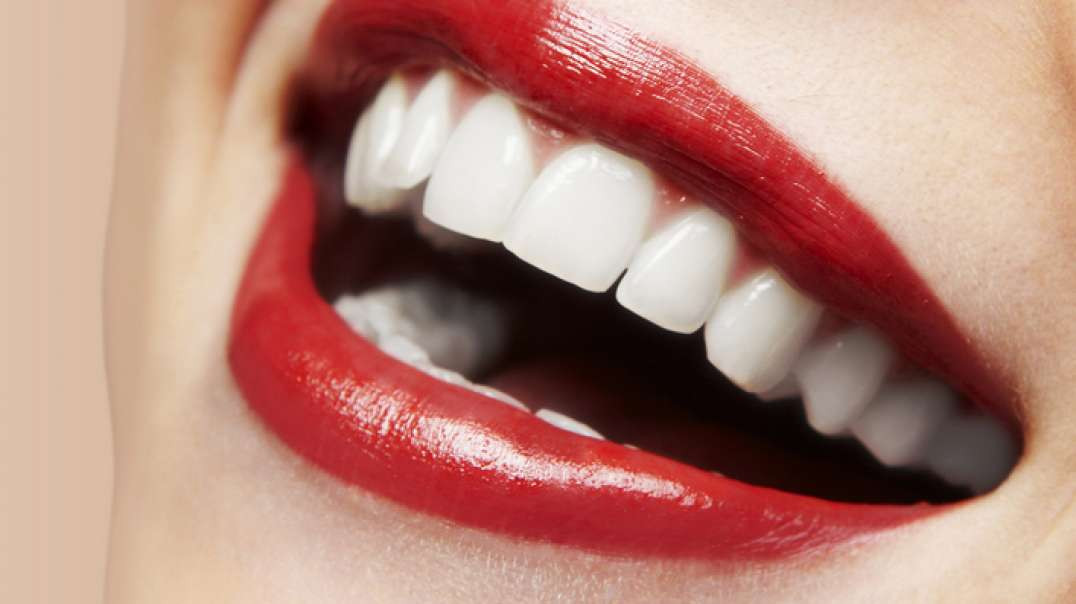 Rielo Dental : Teeth Whitening in Hialeah, FL