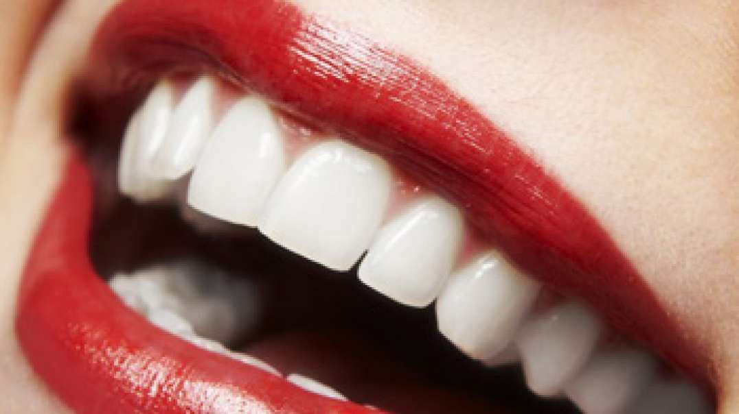 DB Dental Care : Teeth Whitening in Miami, FL | 33165