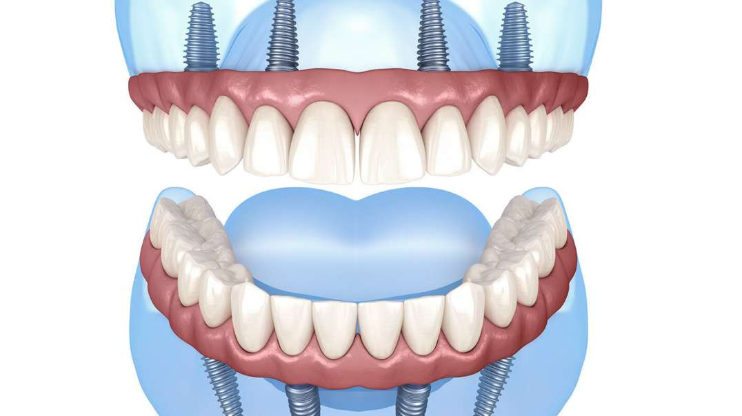 The Smile Studio : Dental Implants in Lake Orion, MI